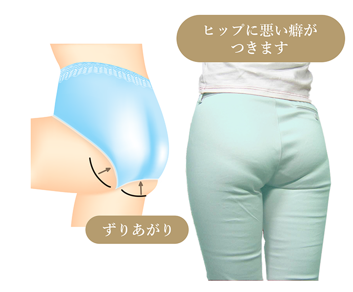 足ぐりが太ももの動きに引っ張られる説明図